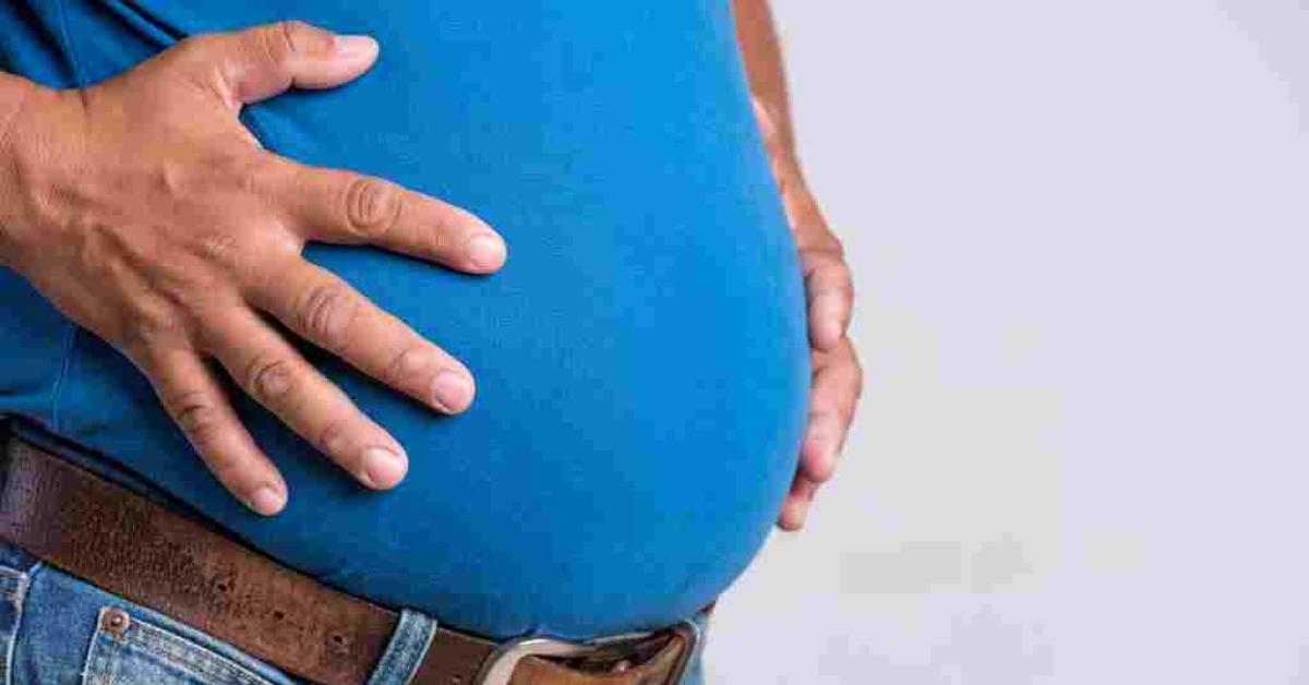 Obesitas atau Masalah Kegemukan Bisa Menimbulkan Perut Gendut, Begini Penjelasannya 