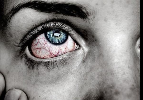 Penyebab Mata Terasa Mengganjal, Ini Jelas Dokter Nadia