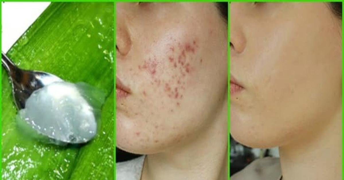 5 Manfaat Maksimal Lidah Buaya bagi Kulit wajah, Salah Satunya Memberi Efek Anti Aging