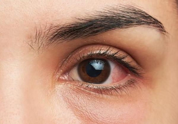 3 Tips Utama Menjaga Kesehatan Mata, Simak di Sini
