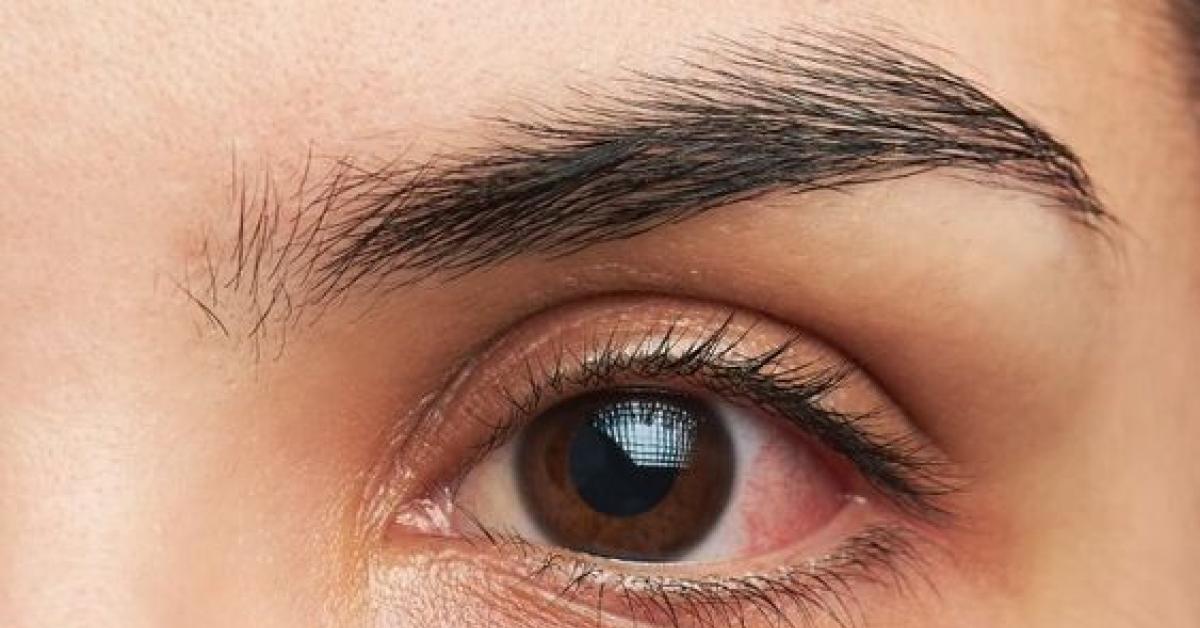 3 Tips Utama Menjaga Kesehatan Mata, Simak di Sini