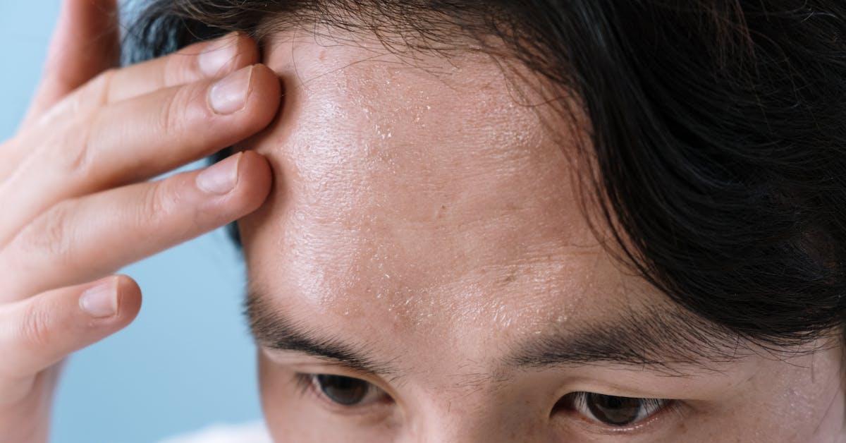 Ciri-ciri Infeksi HIV pada Pria dan Wanita, Perbedaannya di Sini 