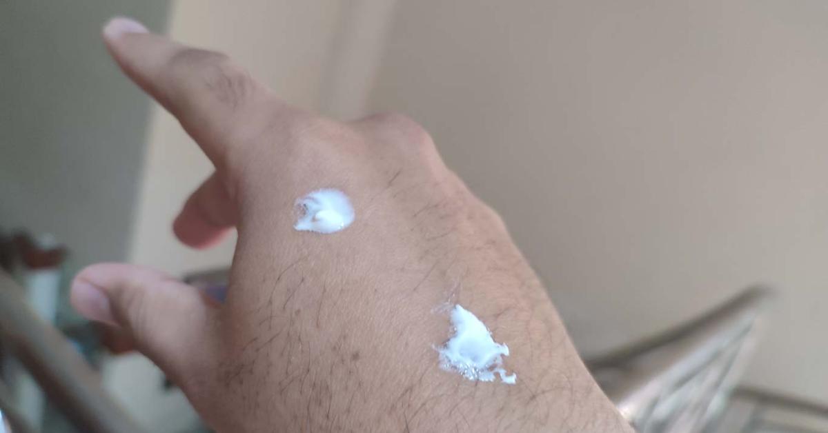Jangan Pakai Odol jika Kena Minyak Panas, Oleskan Ini