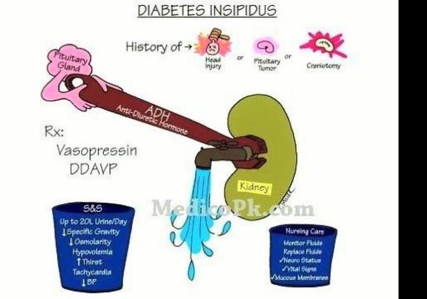 Apa Diabetes Insipidus? Kenali Penyebab dan Gejalanya