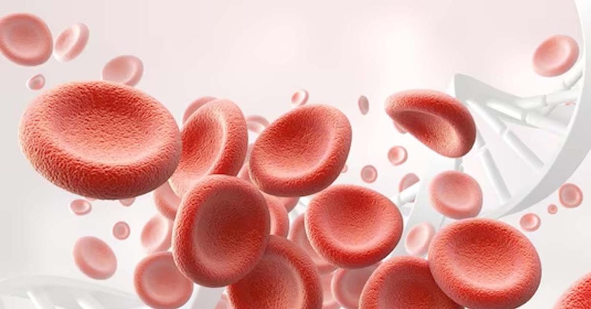 Anemia: Penyebab dan Pengobatannya