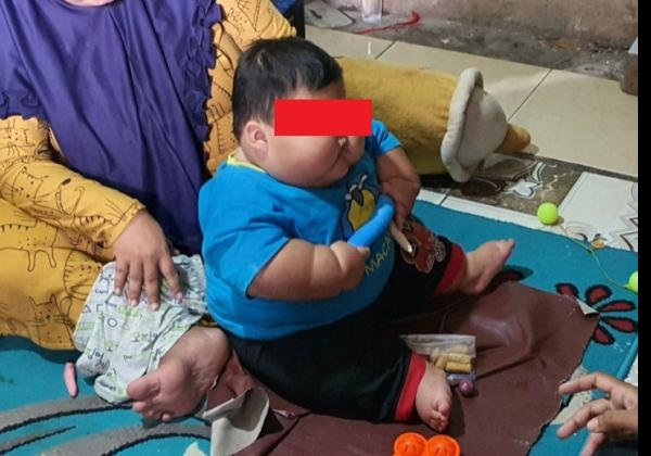 Obesitas! Bayi Umur 1 Tahun di Kabupaten Bekasi Beratnya 27 Kg, Begini Penjelasan Orang Tua