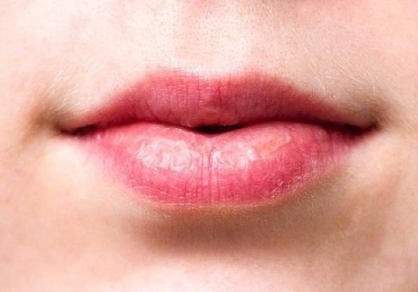 Bibir Terlihat Hitam atau Pucat? Ikuti Tips Mencerahkan Bibir dengan Bahan Alami Berikut Ini