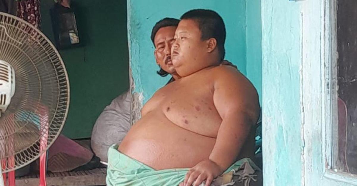 Ini yang Dirasakan Rafka Anak Obesitas Sebelum Meninggal Dunia