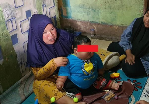 Tidak Pernah Mendapat ASI, Bayi Obesitas di Bekasi Sering Konsumsi Susu Kental Manis
