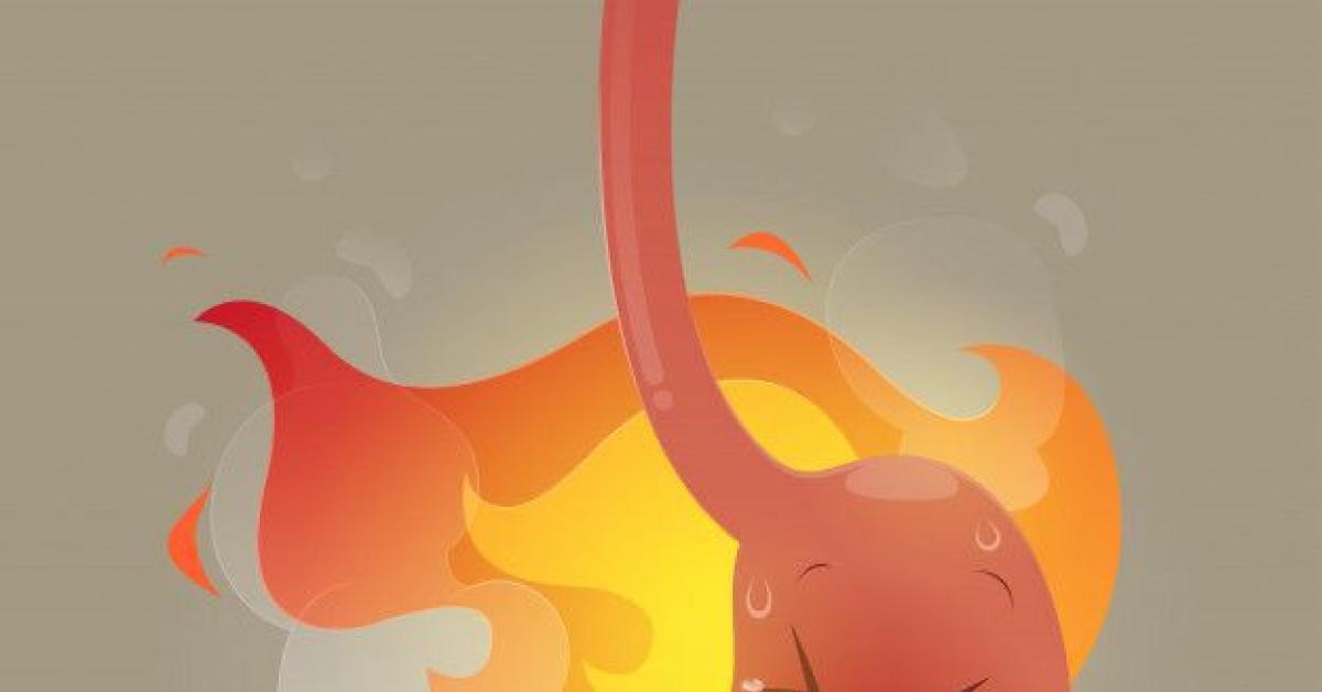 Simak Yuk! Cara Mengatasi Mual Karena Asam Lambung Naik