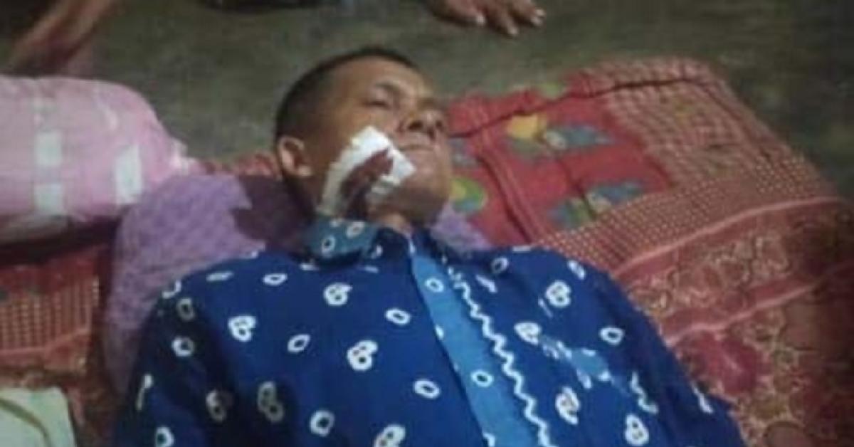 Hendak Pulang ke Rumah, Wartawan Online Dibacok