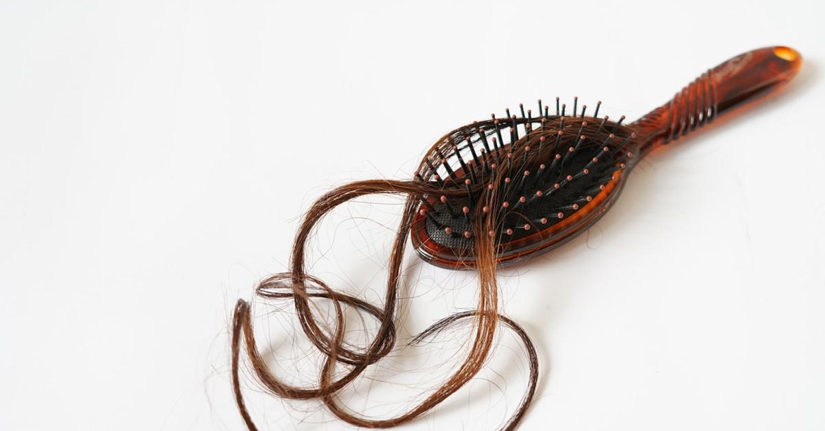 7 Rekomendasi Vitamin Rambut Rontok, Aman Untuk Kesehatan Kulit Kepala