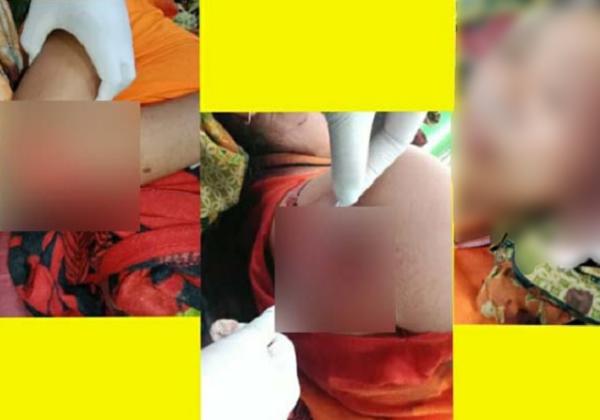 Dituduh Miliki PIL, Istri Dibacok di Kepala, Punggung, Siku Hingga Nyaris Tewas