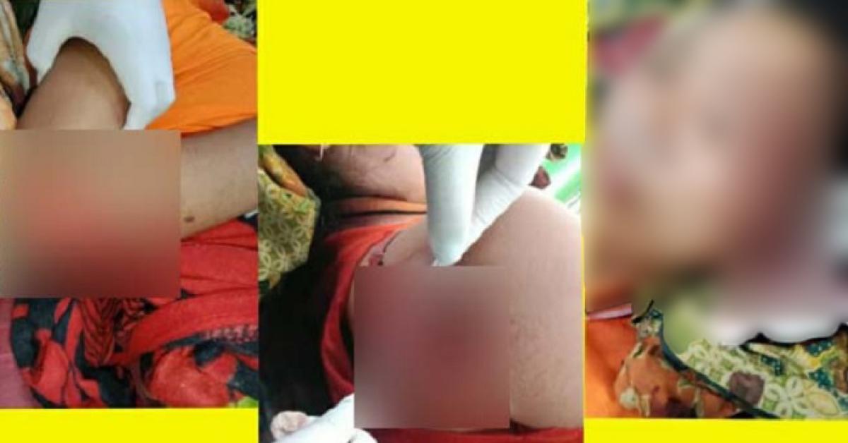 Dituduh Miliki PIL, Istri Dibacok di Kepala, Punggung, Siku Hingga Nyaris Tewas
