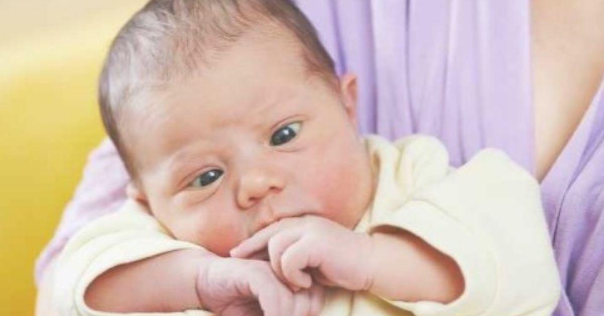 Waspadalah! Nyatanya Mata Juling Bisa Dialami Bayi dan Anak, Berikut Ulasannya