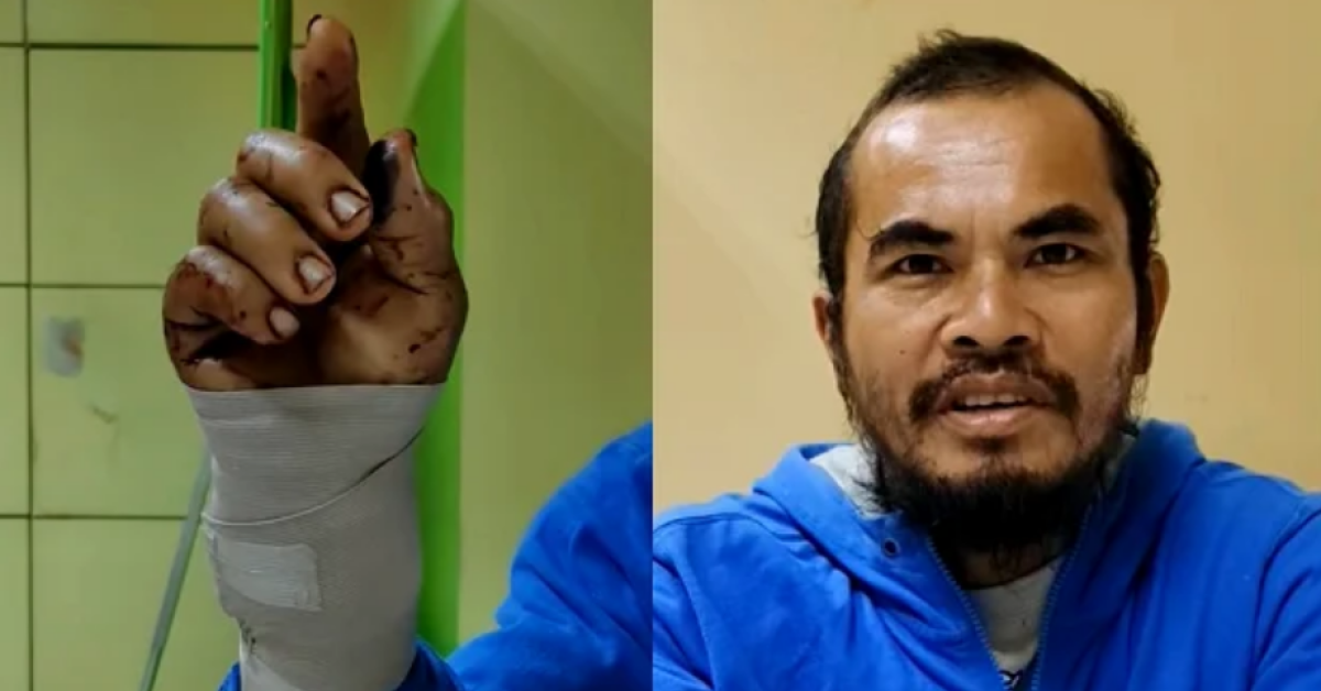 Tak Terima Digigit Ular Piton Panjang 3 Meter, Pria di Filipina Ini Gigit Balik Ular sampai Mati 