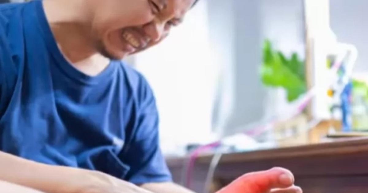 Tak Perlu Pakai Obat, Temukan 5 Cara Menurunkan Asam Urat Secara Alami Menurut Dokter