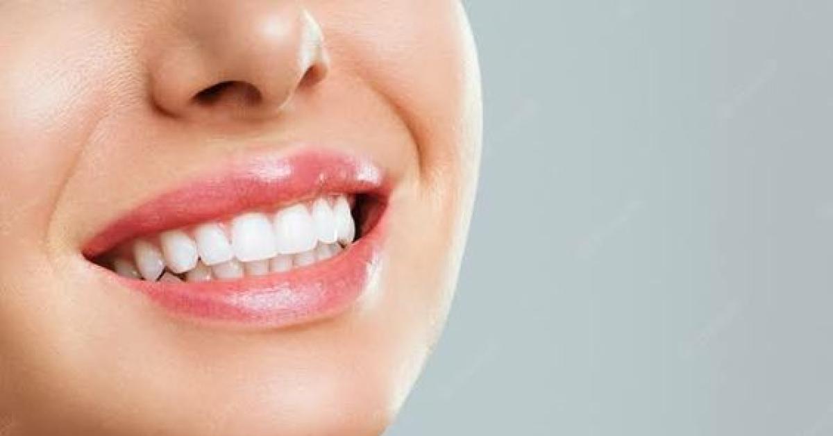 Tips Mencerahkan Gigi Kusam, Kembalikan Rasa Percaya Diri!