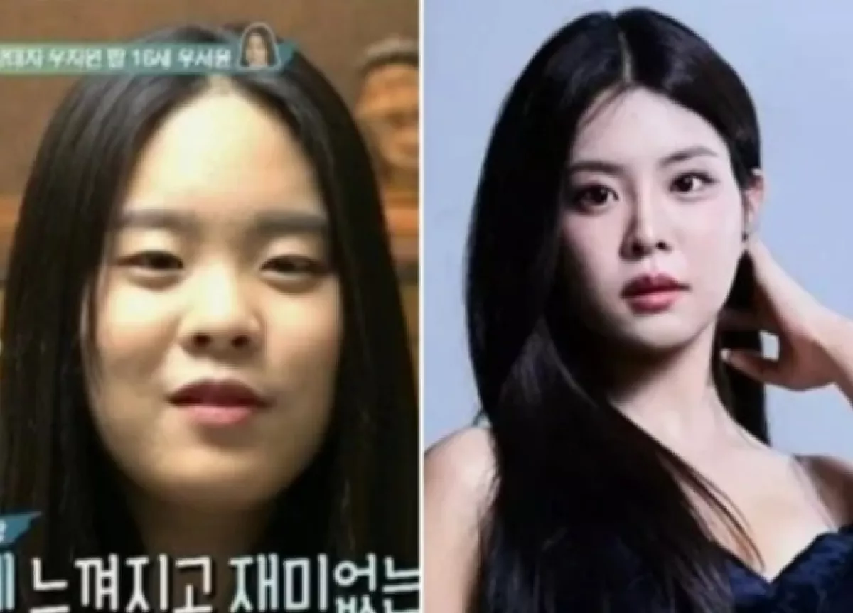 Putri 'Miss Korea Jin' Woo Ji-won, Woo Seo-yoon, Hadapi Kontroversi Operasi Plastik
