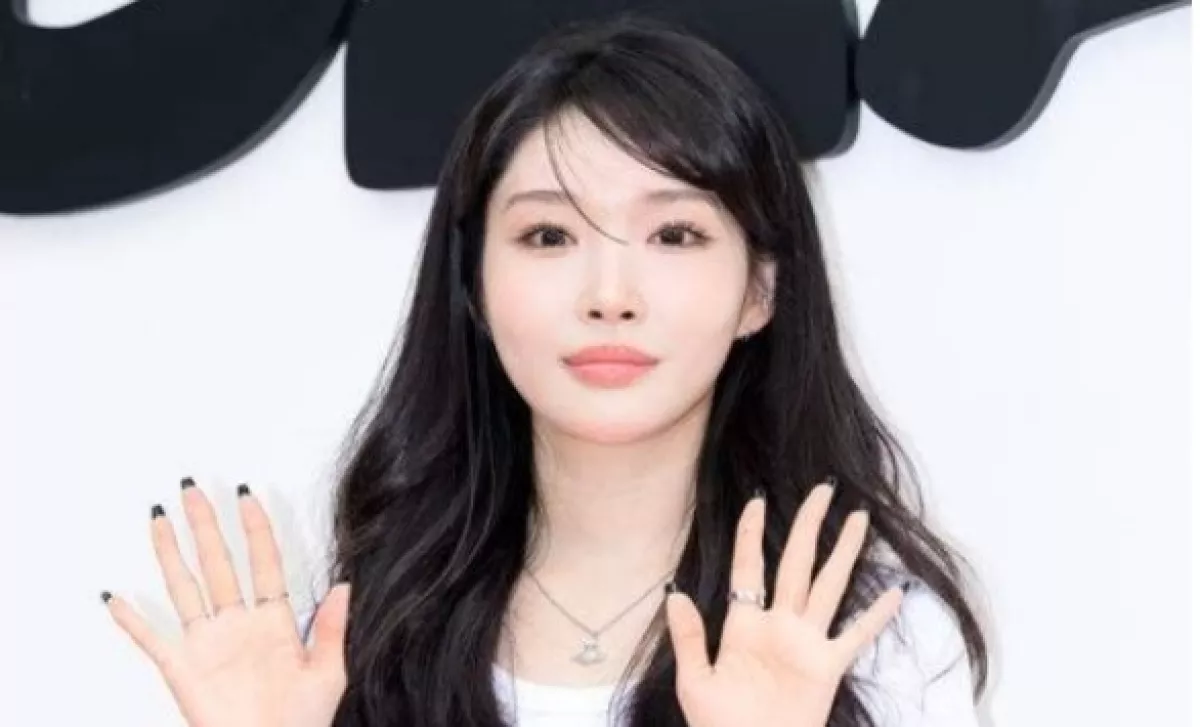 Penyanyi Chungha Akui Perubahan Wajah