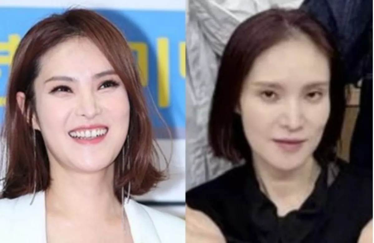 Wajah Gummy Terlihat Lembek 'Kekhawatiran tentang Kesehatannya' Bermunculan