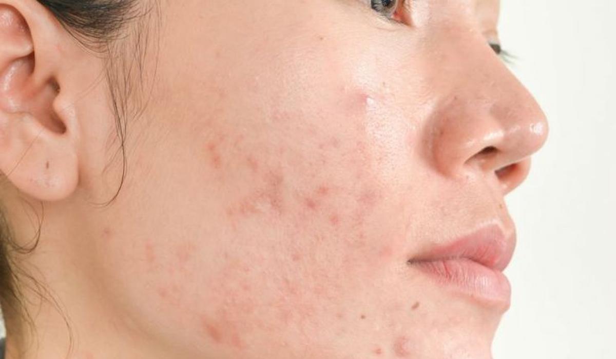Tips Merawat Kulit Kasar Jadi Halus, Cuma Pakai Bahan Alami Berikut Ini