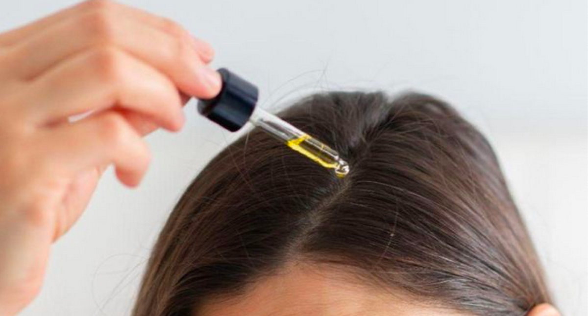 Rahasia Rambut Bebas Lepek dengan Perawatan Mudah di Rumah, Badai Tiap Saat!