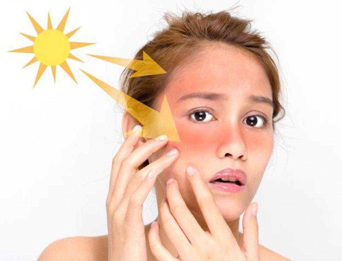 8 Rekomendasi Sunscreen Terbaik untuk Remaja yang Efektif Melindungi Kulit Wajah Dari Paparan Sinar UV