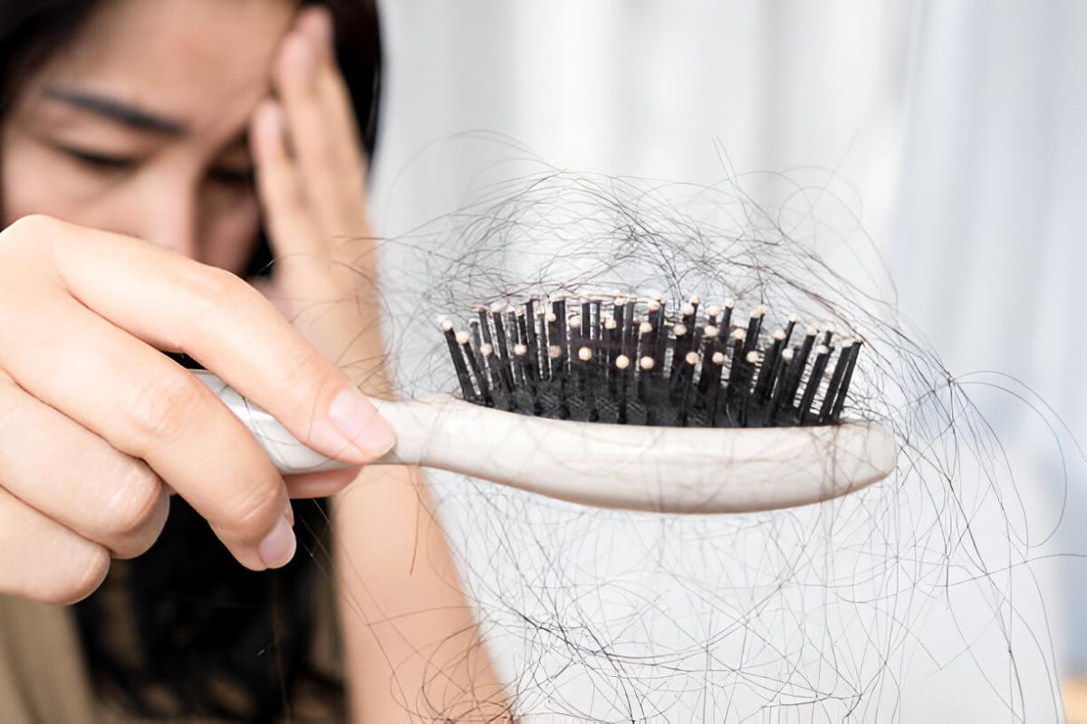 Bukan Sekadar Masalah Sepele: Penyebab Rambut Rontok yang Perlu Diwaspadai