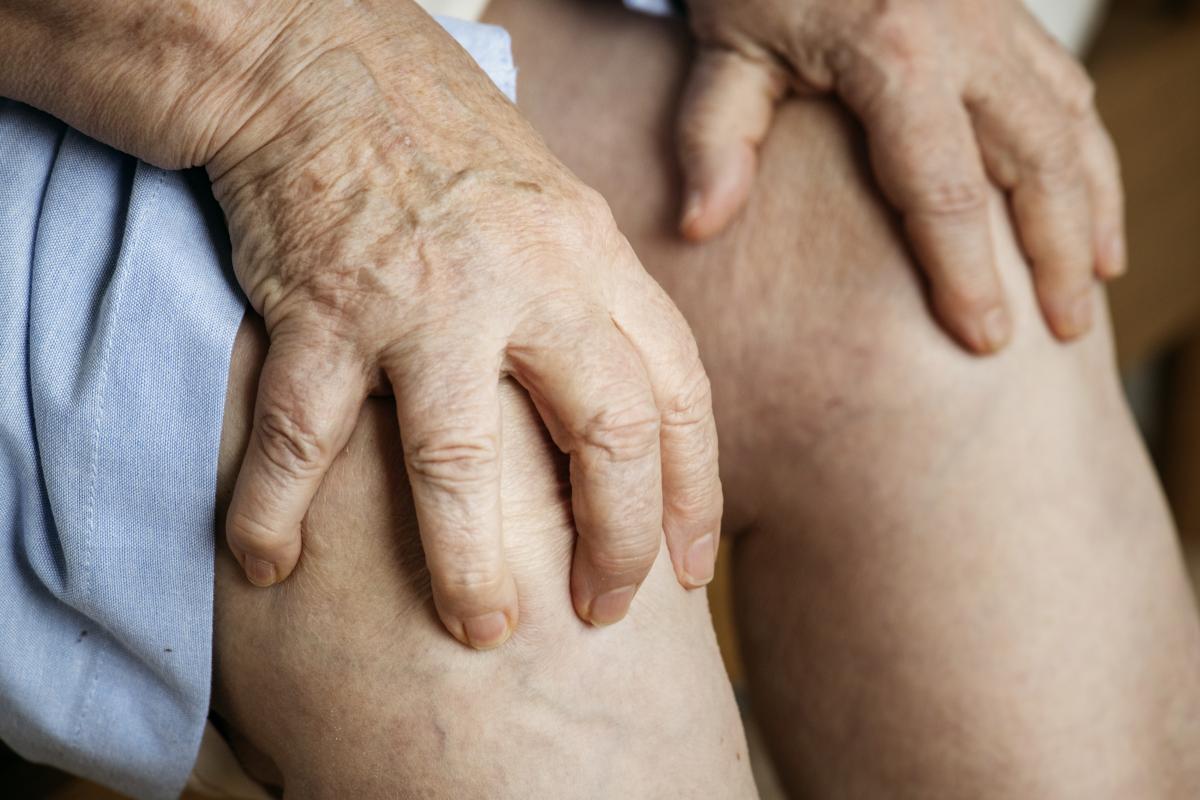 Bye Varises! 8 Cara Ampuh Hilangkan Pembuluh Darah Menonjol di Kaki