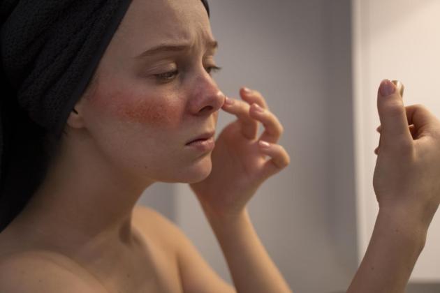 Hati-Hati! Ini 9 Bahan Skincare yang Wajib Dihindari Pemilik Kulit Sensitif, Bikin Wajah Perih dan Merah-Merah
