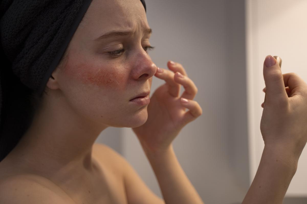Hati-Hati! Ini 9 Bahan Skincare yang Wajib Dihindari Pemilik Kulit Sensitif, Bikin Wajah Perih dan Merah-Merah