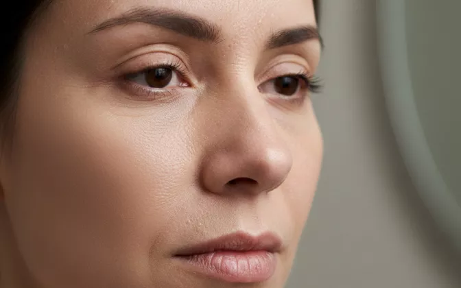 Kulit Kering atau Dehidrasi? Kenali Perbedaannya Agar Tidak Salah Skincare