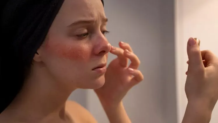 Cara Mengatasi Kulit Kering saat Puasa dengan 4 Kandungan Skincare Terbaik 2026