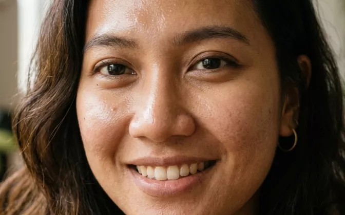 Tips Merawat Kulit Kombinasi Tanpa Harus Laser Jutaan Rupiah