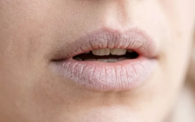 Cara Mengatasi Bibir Pucat Agar Terlihat Merona Alami Tanpa Ribet
