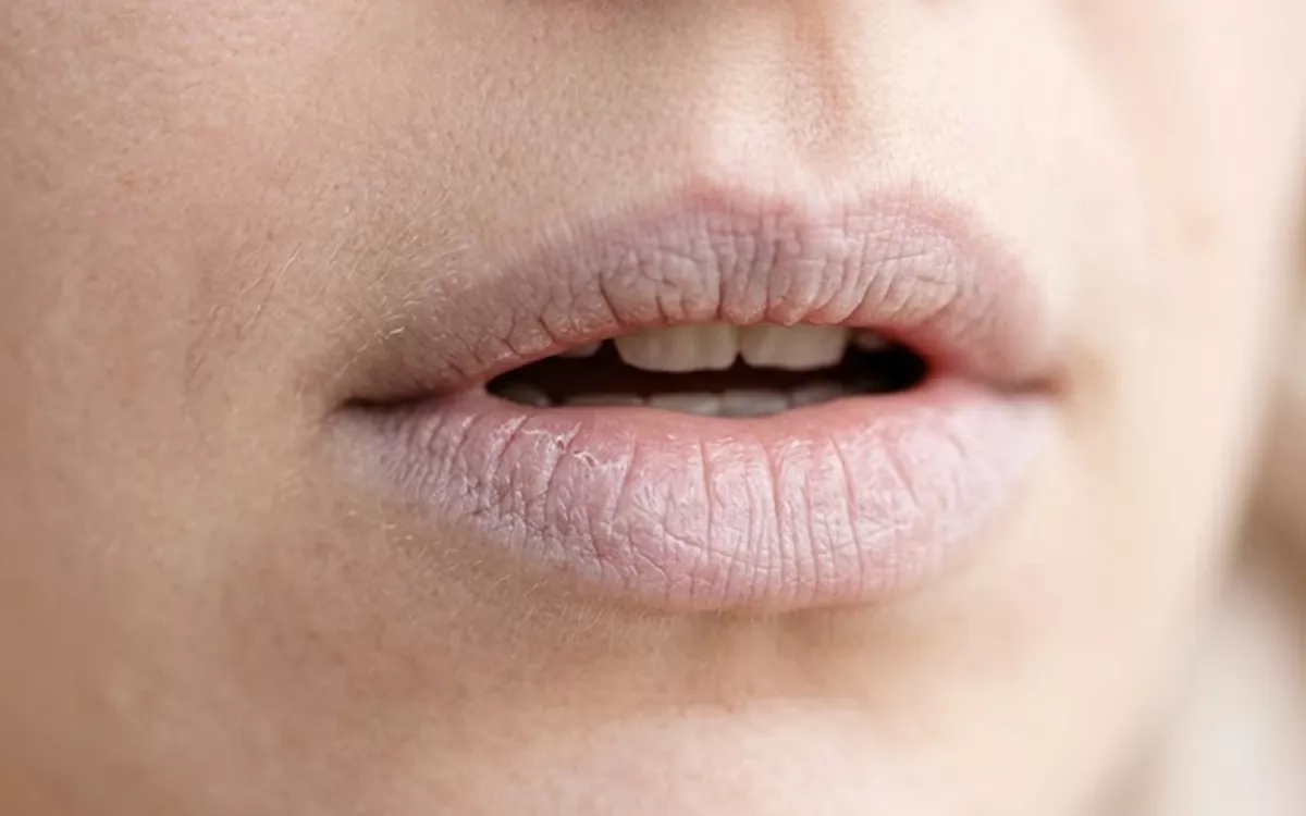 Cara Mengatasi Bibir Pucat Agar Terlihat Merona Alami Tanpa Ribet