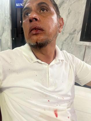 Mediasi Jadi Ricuh, Ustaz Habib Abdul Hakim Jadi Korban Penganiayaan di Bekasi