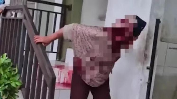 Polisi Tangkap Pelaku Penganiayaan Nenek di Pasar yang Viral Berlumuran Darah