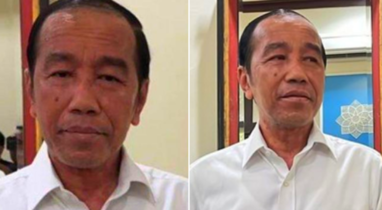 Wajah Bengkak Setelah Lengser, dr Tifa Bilang Jokowi Kena Penyakit Autoimun Systemic: Pembunuh Diam-Diam