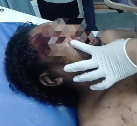 Polisi Benarkan 2 Orang Tewas Dalam Pengeroyokan di Kalibata, Pelaku Diburu