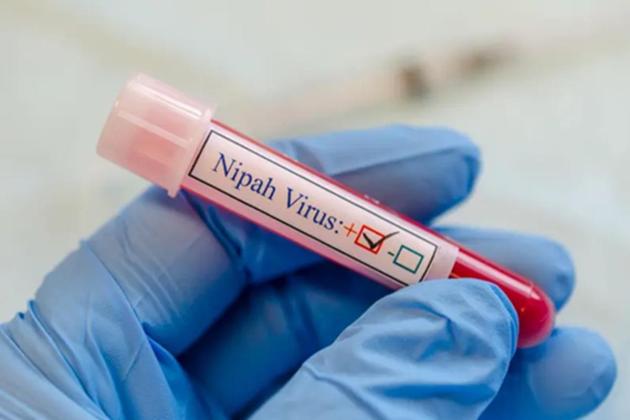 Wamenkes Pastikan Virus Nipah Belum Masuk ke Indonesia