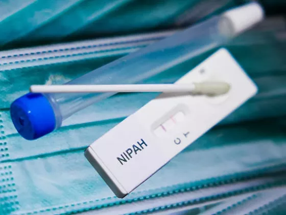 BRIN Peringatkan we Bahaya Serius: Kuliner Satwa Liar dan Pasar Kotor Jadi Jalur Masuk Virus Nipah