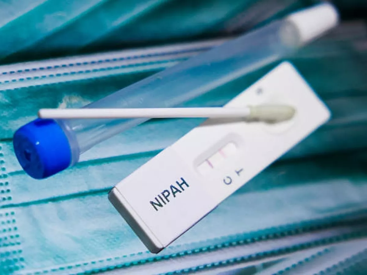 BRIN Peringatkan we Bahaya Serius: Kuliner Satwa Liar dan Pasar Kotor Jadi Jalur Masuk Virus Nipah