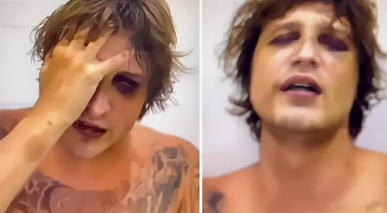 DETIK-DETIK TERAKHIR! Video IGOR KOMAROV Menangis Sebelum DIBUNUH & DIMUTILASI di Bali: SAYA SEKARAT, Selamatkan Saya, Bawa Saya Pulang