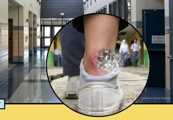 Viral! Mandala Rizky Putra, Siswa SMK di Samarinda Meninggal Dunia, Diduga Gara-Gara Sepatu Kesempitan