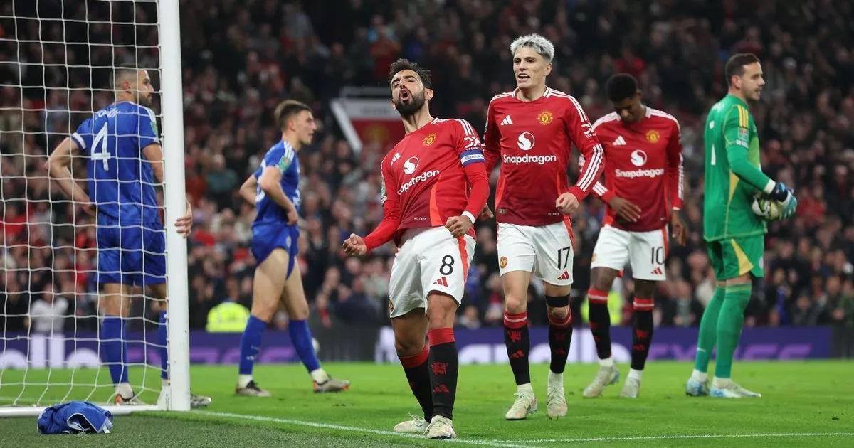 Prediksi Leicester City vs Manchester United di Liga Inggris 2024-2025: Setan Merah Incar Kemenangan 