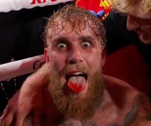 Rahang Patah Dihantam Anthony Joshua, Jake Paul Akui Kesulitan Bicara