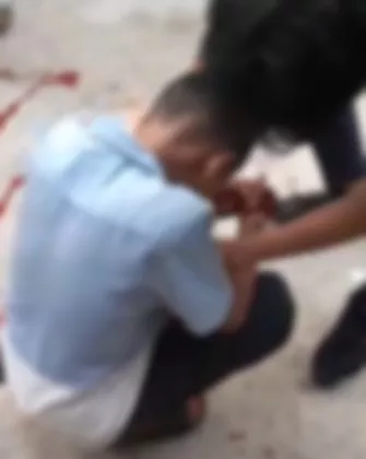 Niat Nonton Tawuran, Pelajar SMP di Solear Kena Sabet Sajam Usai Motor Mogok
