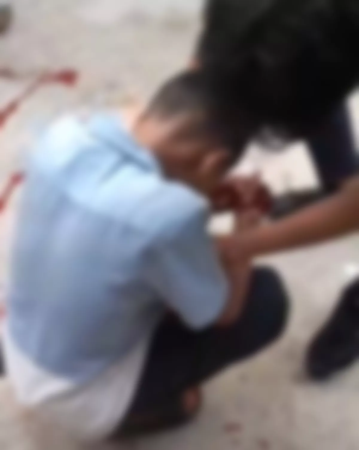 Niat Nonton Tawuran, Pelajar SMP di Solear Kena Sabet Sajam Usai Motor Mogok